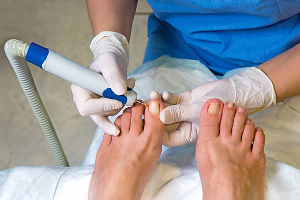 Podiatrist treating the patient suffering from the ingrown nail.